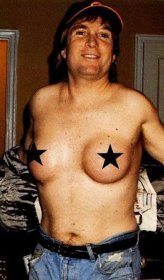 Gambler with breast implants