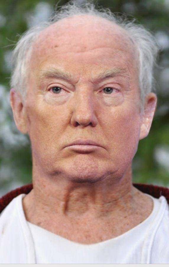 Donald Trump without his trademark hair and orange tan